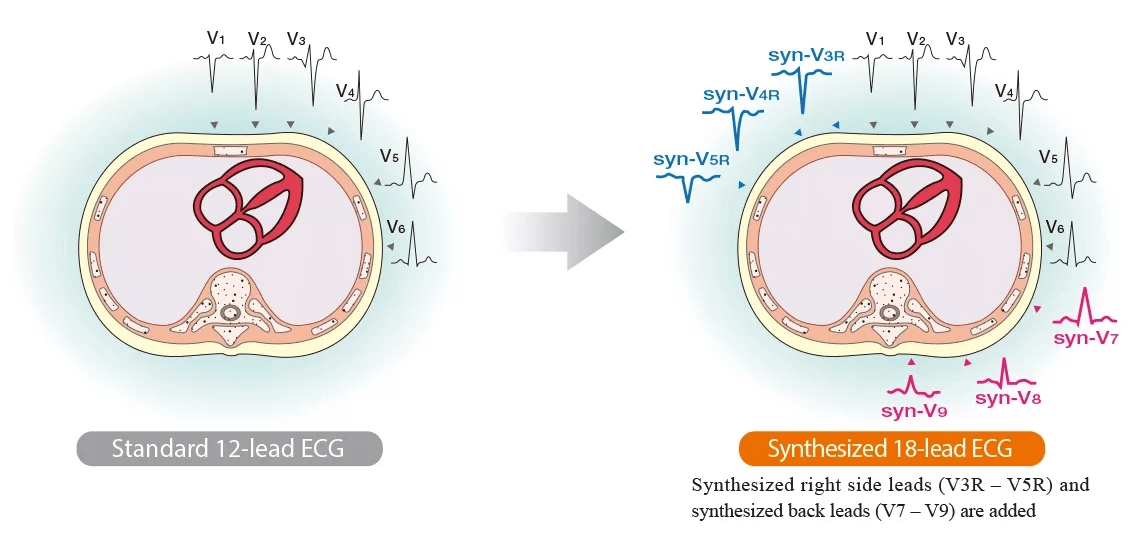 syneci_01