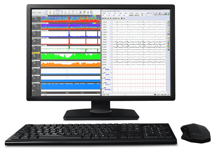 EEG Trend Software