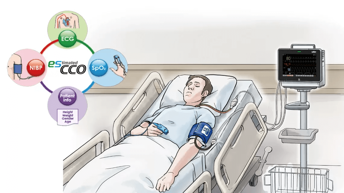 The ICU is changing: Why advanced non-invasive haemodynamic monitoring is gaining ground – Featuring esCCO by Nihon Kohden. 