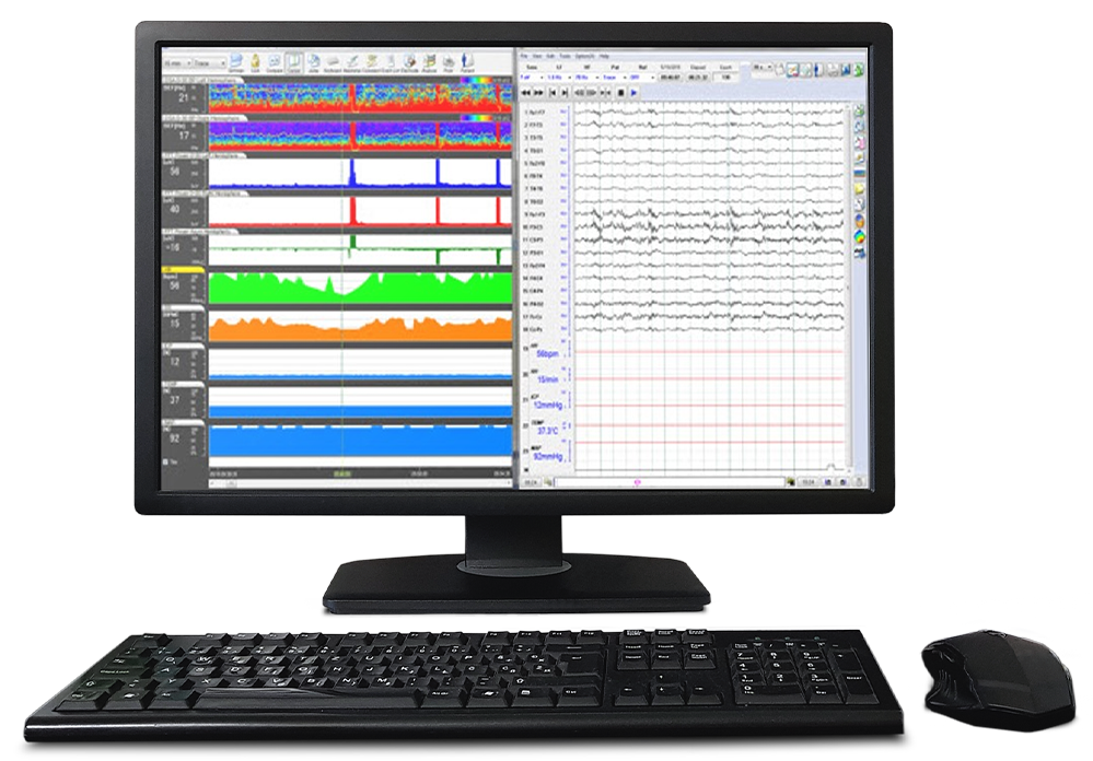 EEG Trend Software