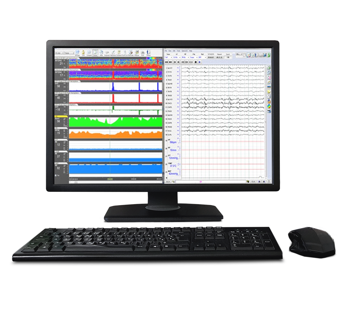 EEG Trend Software